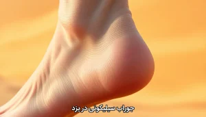 جوراب سیلیکونی در یزد