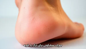 جوراب سیلیکونی برای ترک پا خوبه