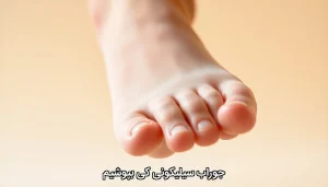جوراب سیلیکونی کی بپوشیم